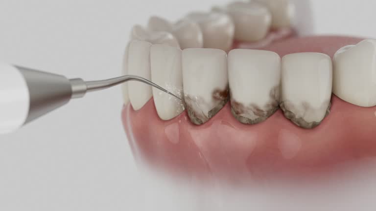 Trusted Dental Implants service in Canadian Lakes, MI - Dentist Open Now